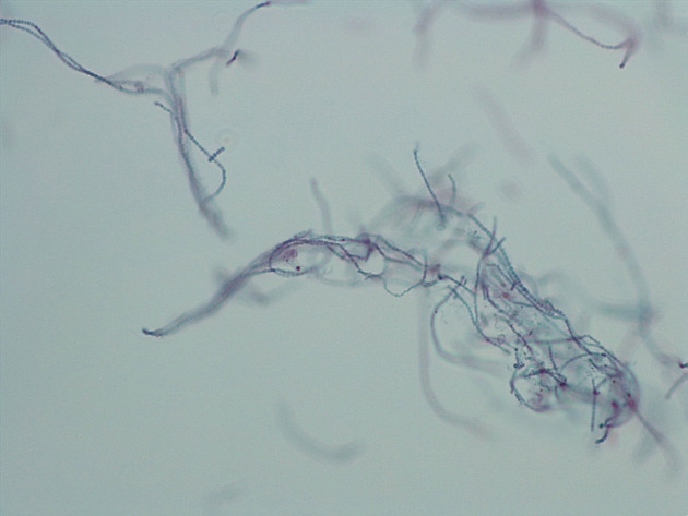 Anabaena Slides - Anabaena 05 100X